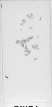 2026AP11320B1-11 macro
