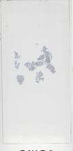 2026AP11320B1-2 macro